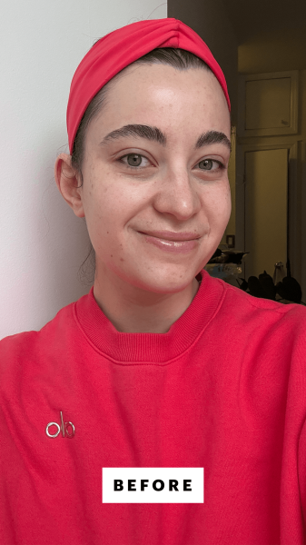 Felbin before applying the Este Lauder Advanced Night Repair Synchronized MultiRecovery Complex Serum